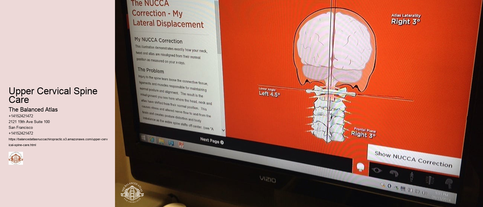 Upper Cervical Spine Care
